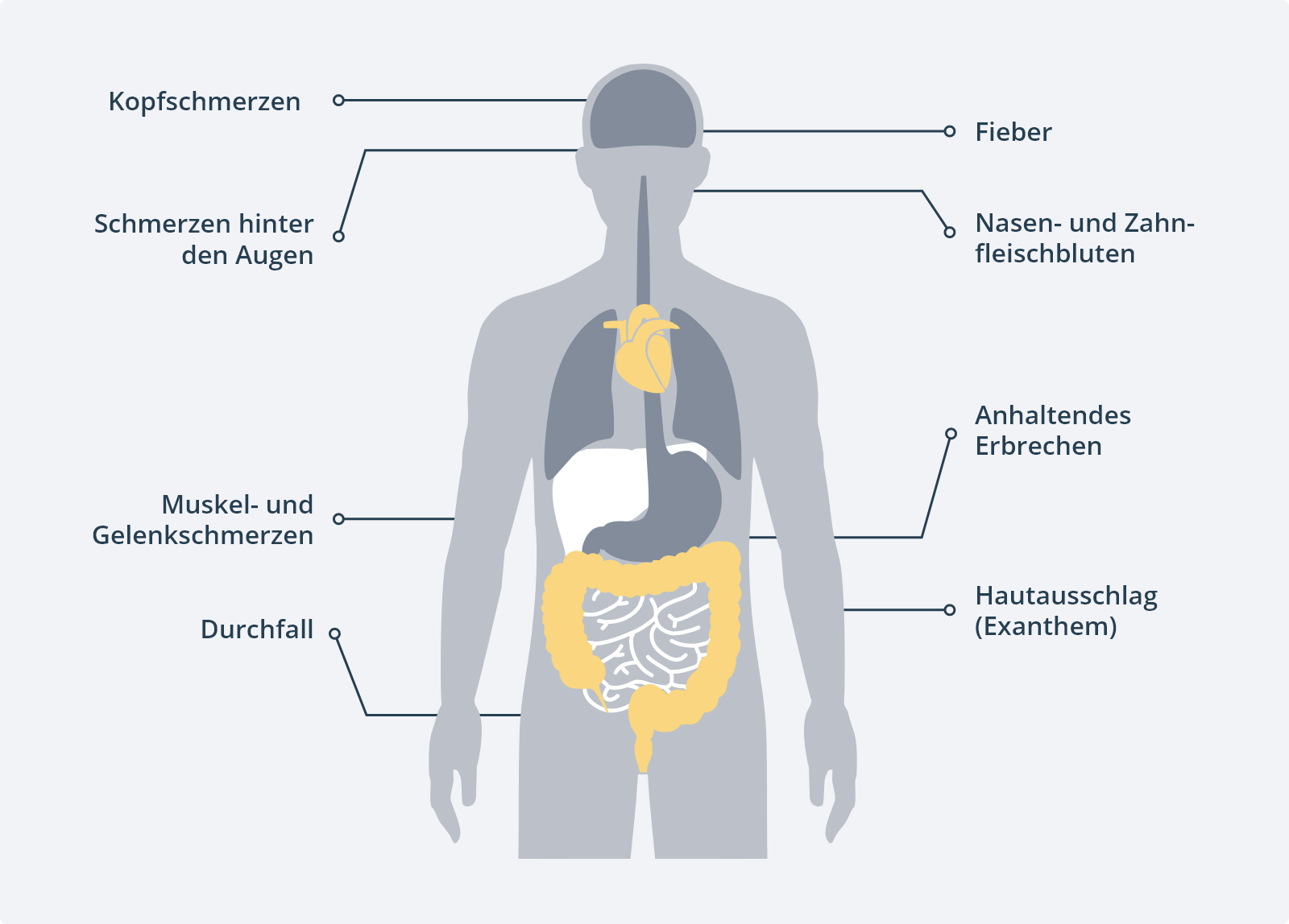 Typische Symptome Dengue