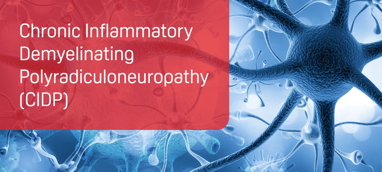 CIDP